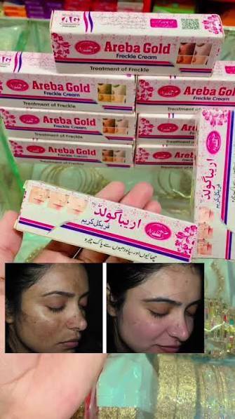 Areba Gold