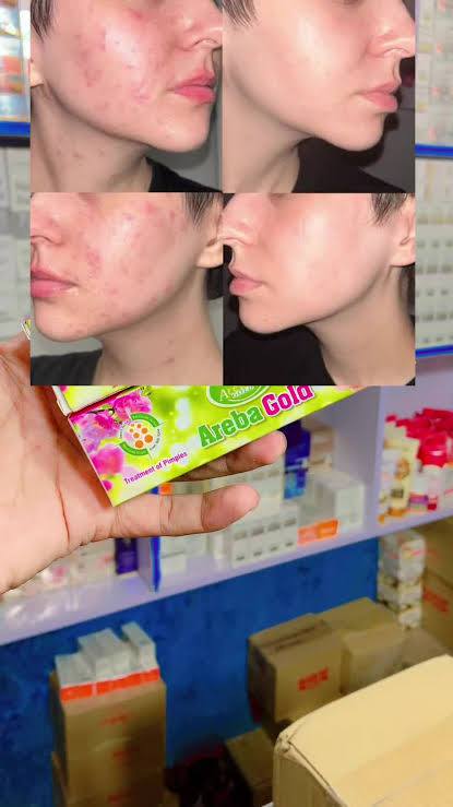 Areba Gold